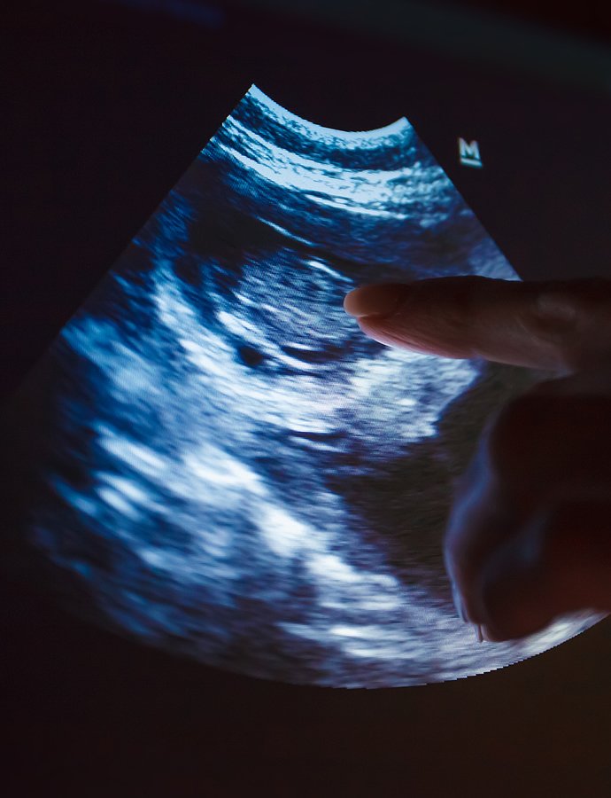 Ultrasound