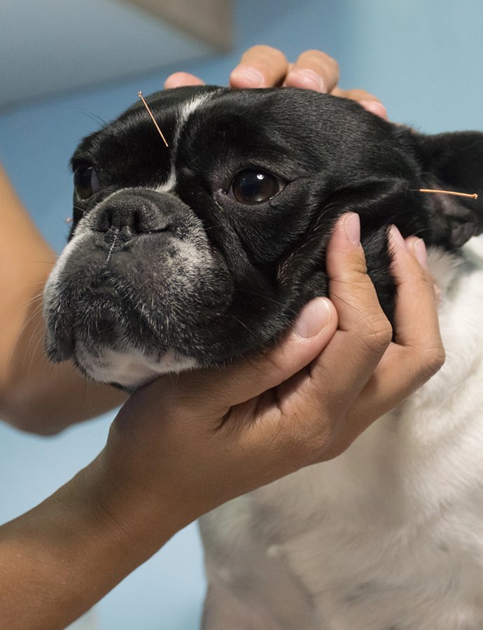 Acupuncture