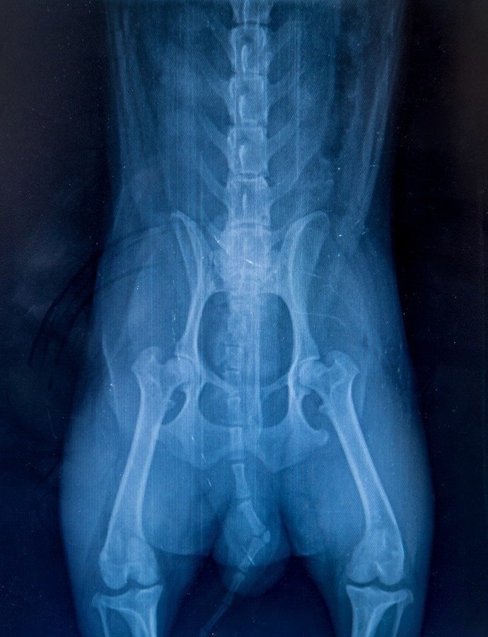X-ray